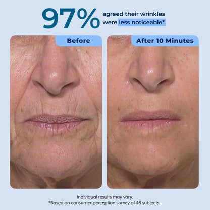Rapid Reduction Serum – 1-Month Supply